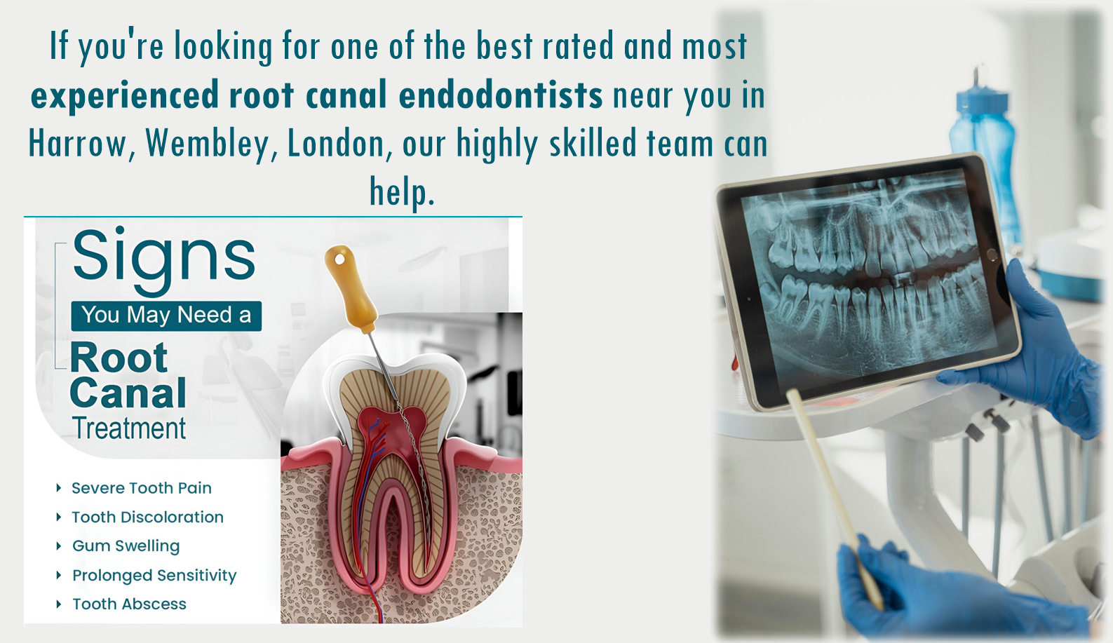 Endodontist Near Me Northolt Harrow Endodontist Near Me Northolt Harrow